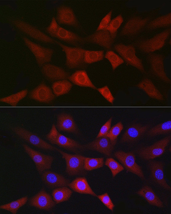 PGD Antibody in Immunocytochemistry (ICC/IF)