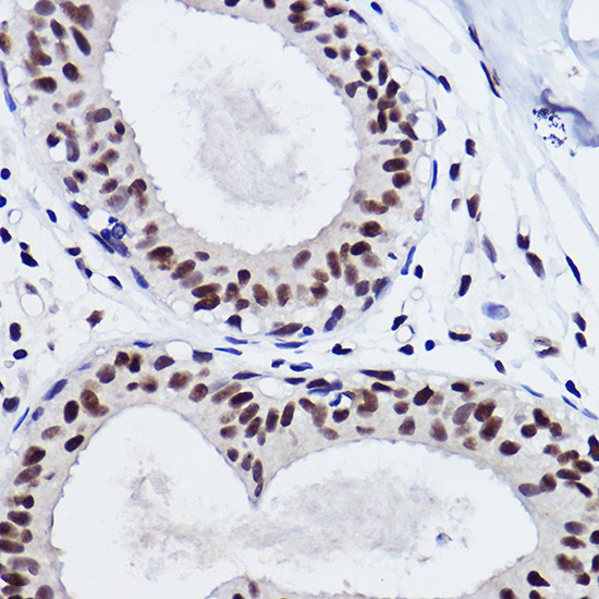 SNRPA1 Antibody in Immunohistochemistry (Paraffin) (IHC (P))
