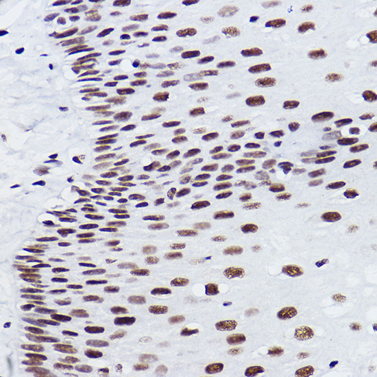 BRMS1 Antibody in Immunohistochemistry (Paraffin) (IHC (P))