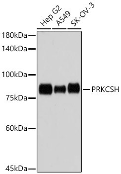 PRKCSH Antibody in Western Blot (WB)