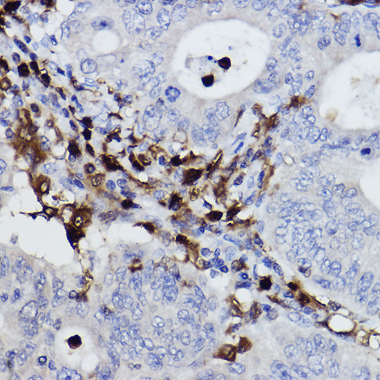 NCF4 Antibody in Immunohistochemistry (Paraffin) (IHC (P))