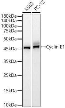 Cyclin E Antibody in Western Blot (WB)