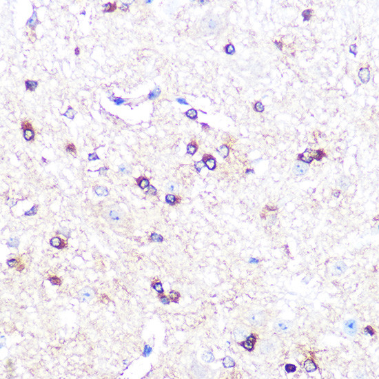 IDO Antibody in Immunohistochemistry (Paraffin) (IHC (P))