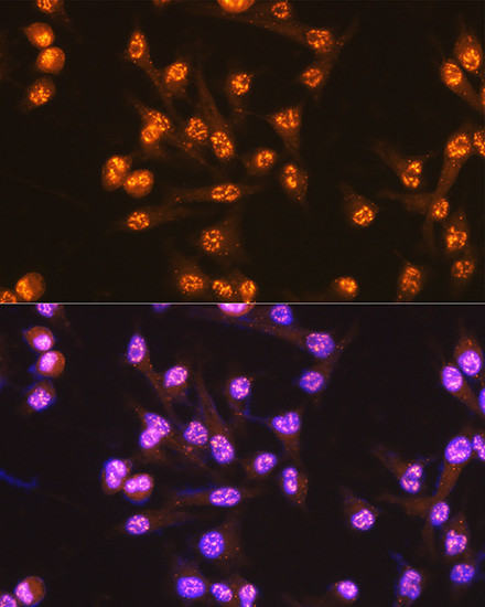CDC25C Antibody in Immunocytochemistry (ICC/IF)