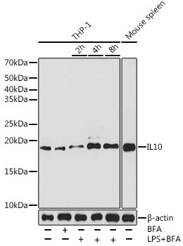 IL-10 Antibody in Western Blot (WB)