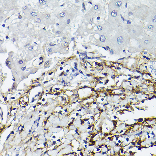 CD90 (Thy1) Antibody in Immunohistochemistry (Paraffin) (IHC (P))