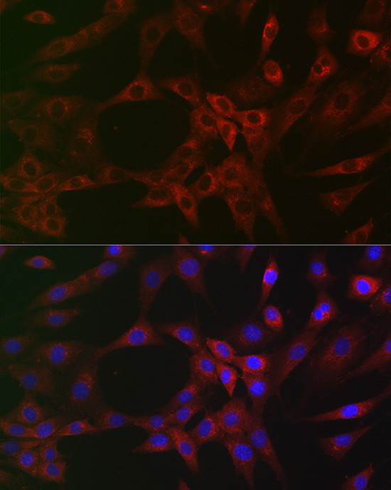ARPC2 Antibody in Immunocytochemistry (ICC/IF)