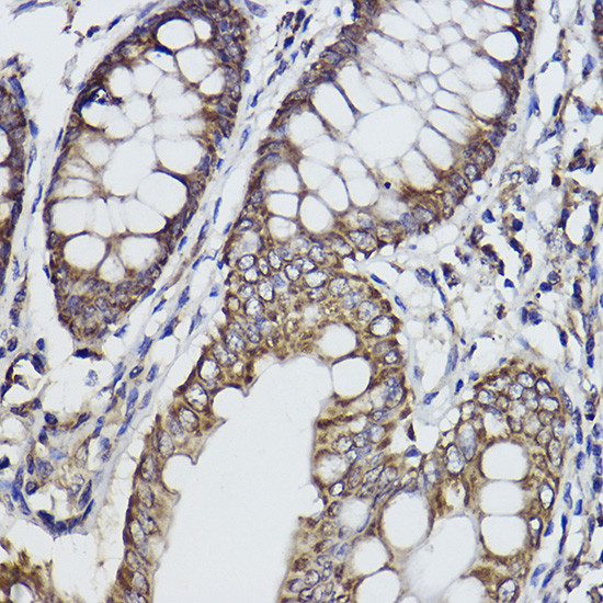 FKTN Antibody in Immunohistochemistry (Paraffin) (IHC (P))