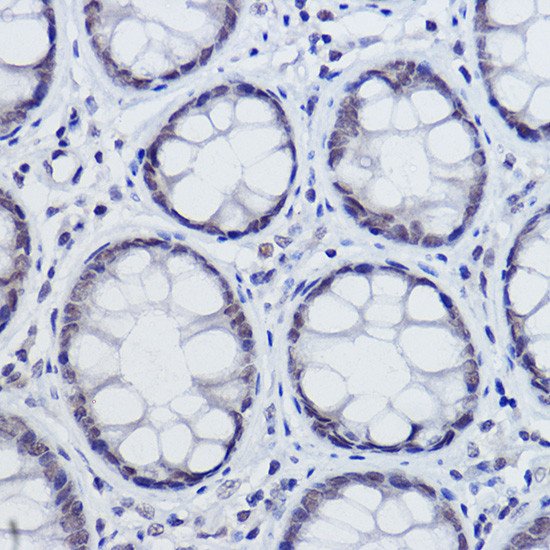 USP39 Antibody in Immunohistochemistry (Paraffin) (IHC (P))