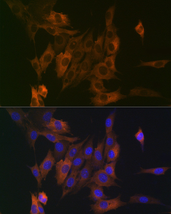 LPP Antibody in Immunocytochemistry (ICC/IF)