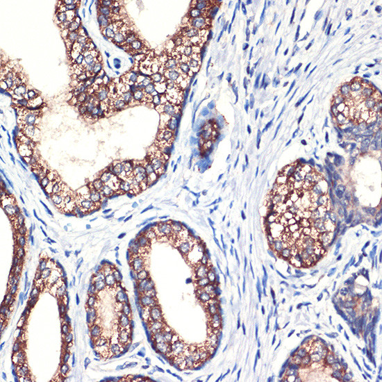 Arginase 2 Antibody in Immunohistochemistry (Paraffin) (IHC (P))