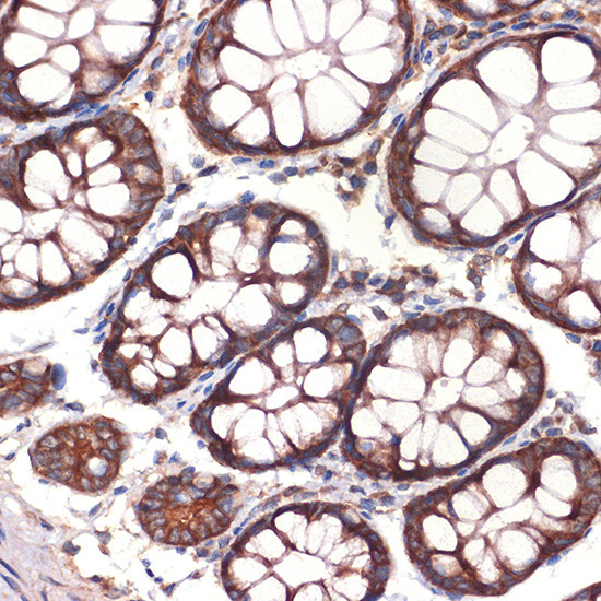 CC2D1A Antibody in Immunohistochemistry (Paraffin) (IHC (P))