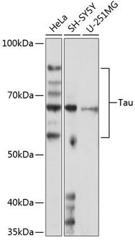 Tau Antibody in Western Blot (WB)