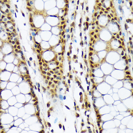 MAD2L1BP Antibody in Immunohistochemistry (Paraffin) (IHC (P))