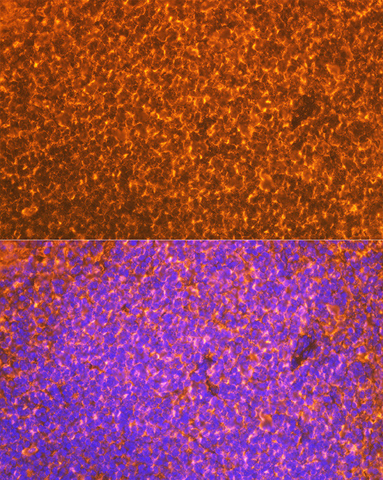 EBI3 Antibody in Immunohistochemistry (Paraffin) (IHC (P))