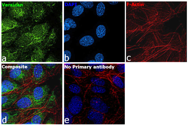 Versican Antibody in Immunocytochemistry (ICC/IF)