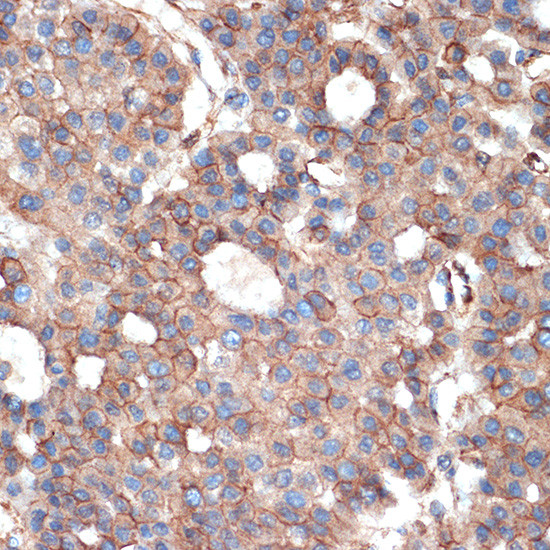 Plectin Antibody in Immunohistochemistry (Paraffin) (IHC (P))