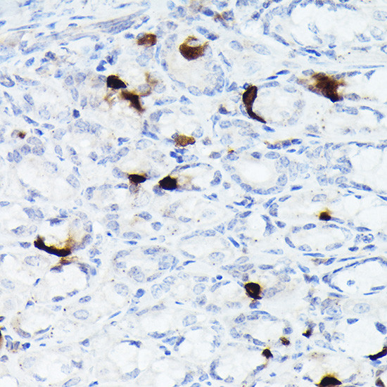 Somatostatin Antibody in Immunohistochemistry (Paraffin) (IHC (P))