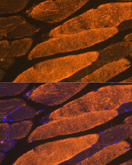 ACTA1 Antibody in Immunohistochemistry (Paraffin) (IHC (P))