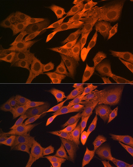 SRP54 Antibody in Immunocytochemistry (ICC/IF)