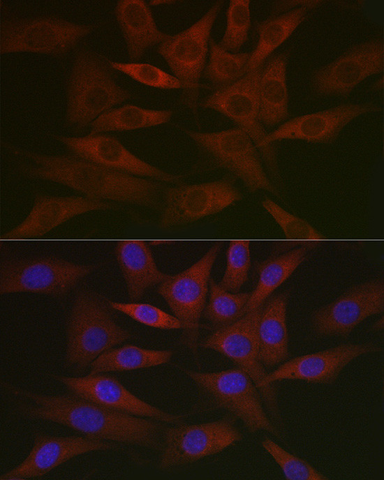 RCL Antibody in Immunocytochemistry (ICC/IF)