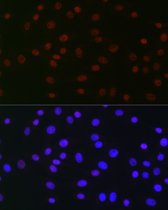 USP39 Antibody in Immunocytochemistry (ICC/IF)