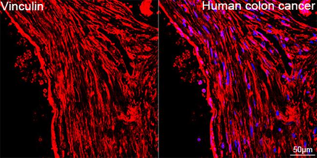 Vinculin Antibody in Immunohistochemistry (Paraffin) (IHC (P))
