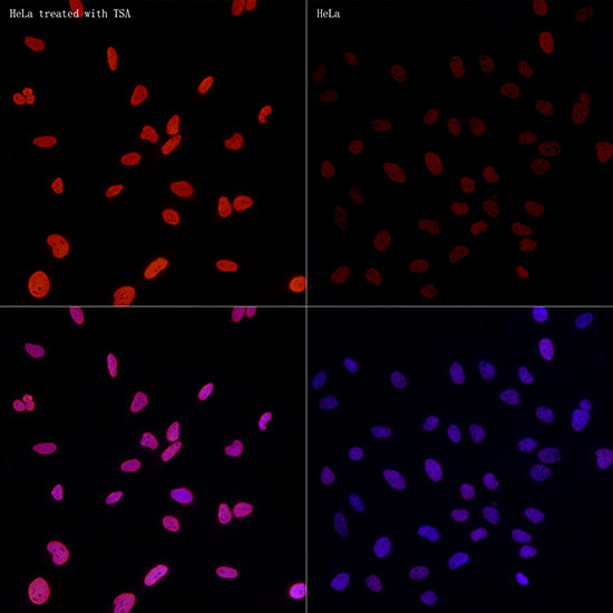 H3K27ac Antibody in Immunocytochemistry (ICC/IF)