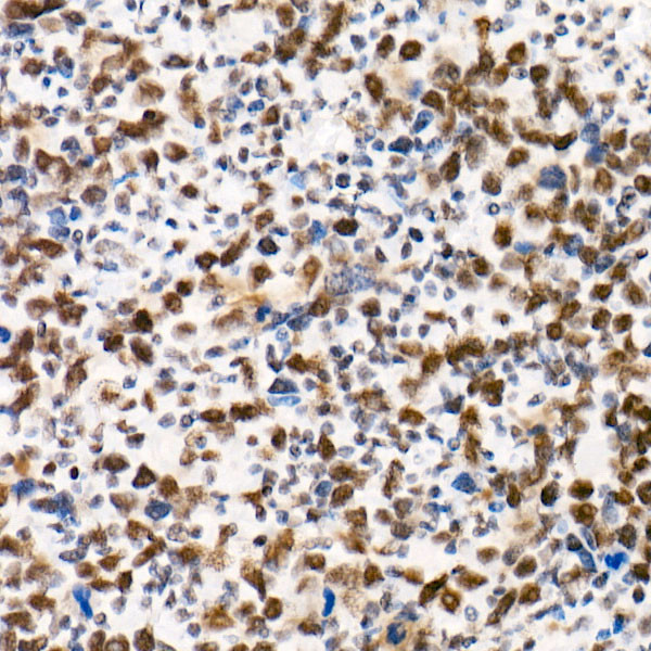 SMARCB1 Antibody in Immunohistochemistry (Paraffin) (IHC (P))