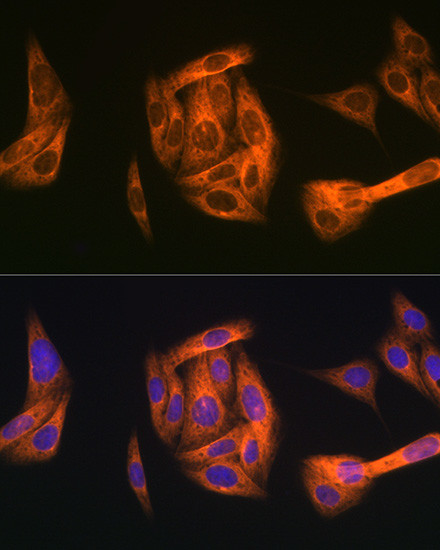 TAB1 Antibody in Immunocytochemistry (ICC/IF)