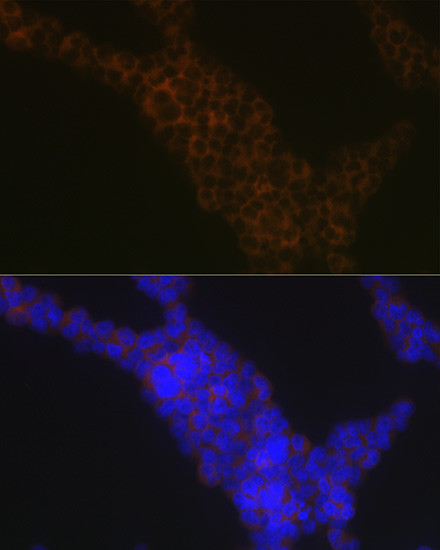 LSP1 Antibody in Immunocytochemistry (ICC/IF)