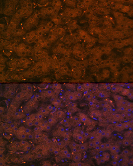 Complement C4a Antibody in Immunohistochemistry (Paraffin) (IHC (P))