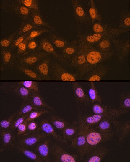 APC6 Antibody in Immunocytochemistry (ICC/IF)