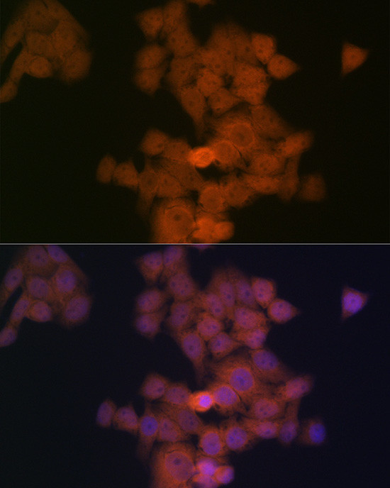 PFDN5 Antibody in Immunocytochemistry (ICC/IF)
