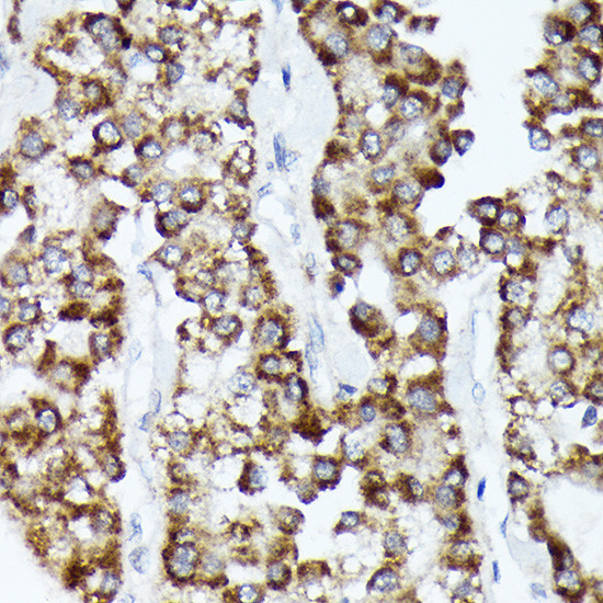 CDCA3 Antibody in Immunohistochemistry (Paraffin) (IHC (P))