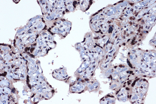 JunD Antibody in Immunohistochemistry (Paraffin) (IHC (P))