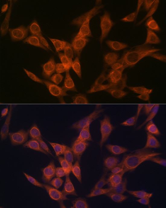ULK3 Antibody in Immunocytochemistry (ICC/IF)