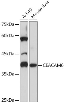 CEACAM6 Antibody in Western Blot (WB)