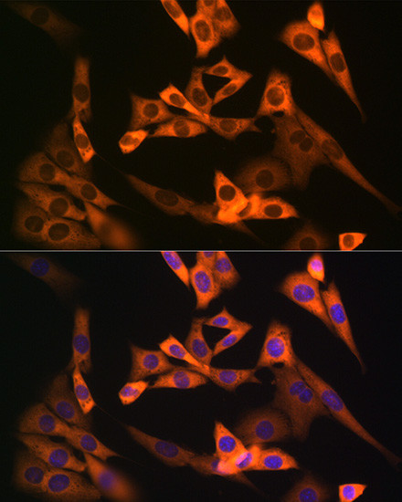NAP1L1 Antibody in Immunocytochemistry (ICC/IF)