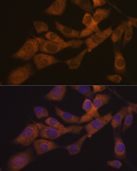 KIF3A Antibody in Immunocytochemistry (ICC/IF)