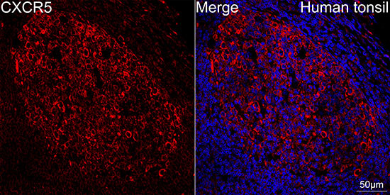 CXCR5 Antibody in Immunohistochemistry (Paraffin) (IHC (P))