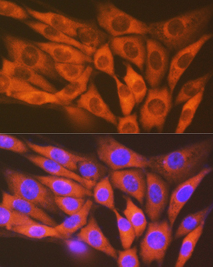 MST2 Antibody in Immunocytochemistry (ICC/IF)