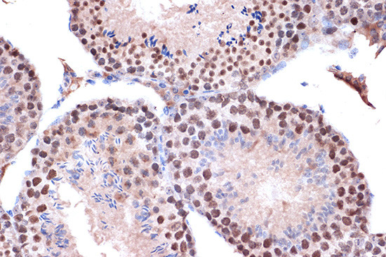 KIF4A Antibody in Immunohistochemistry (Paraffin) (IHC (P))