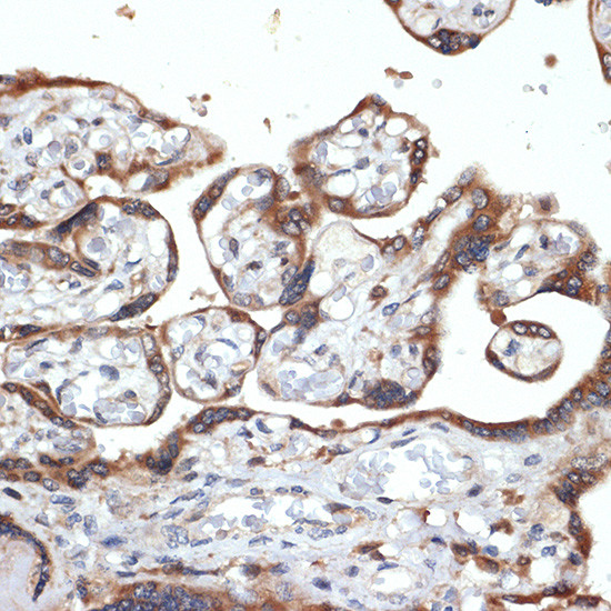 FGFR4 Recombinant Monoclonal Antibody 2C4E1 MA5 42915 fgfr4-recombinant-monoclonal-antibody-2c4e1-ma5-42915