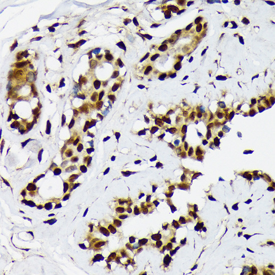 ILF2 Antibody in Immunohistochemistry (Paraffin) (IHC (P))