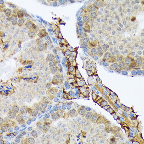 PLTP Antibody in Immunohistochemistry (Paraffin) (IHC (P))