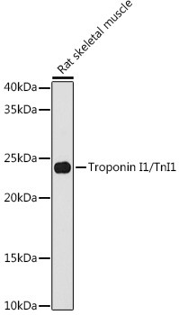 TNNI1 Antibody in Western Blot (WB)