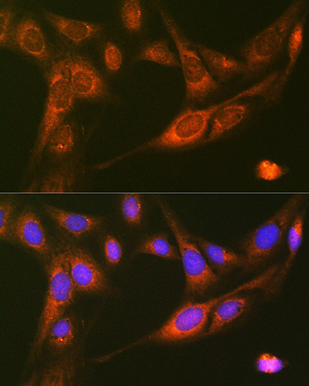 RALBP1 Antibody in Immunocytochemistry (ICC/IF)