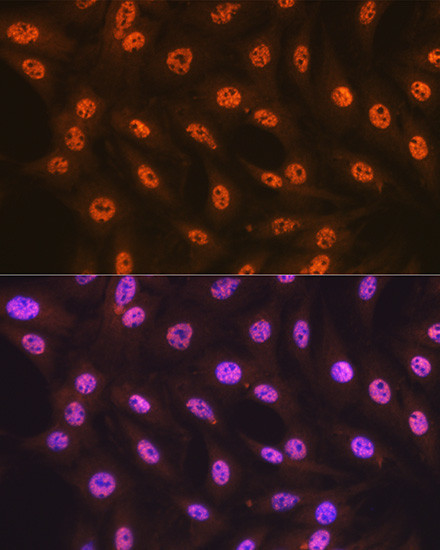 SF3B1 Antibody in Immunocytochemistry (ICC/IF)
