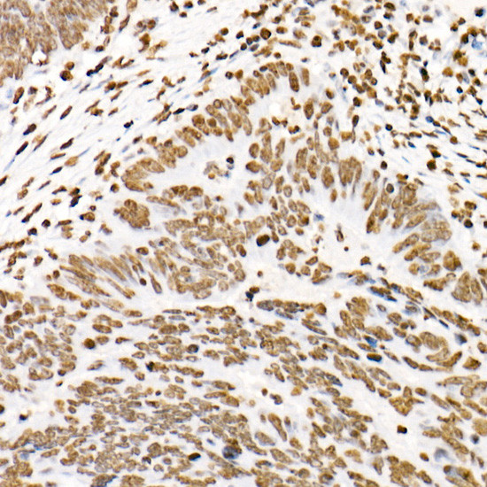 Phospho-STAT3 (Tyr705) Antibody in Immunohistochemistry (Paraffin) (IHC (P))